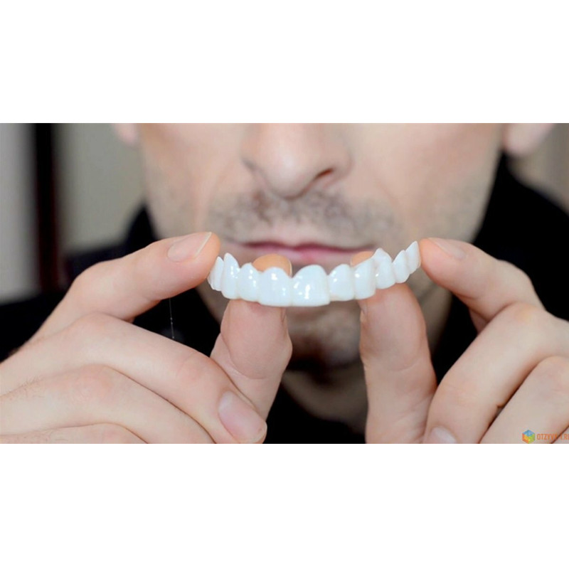 Zachte Siliconen Gel Dental Or - Teeth Whitening Moulds recensie en prijs