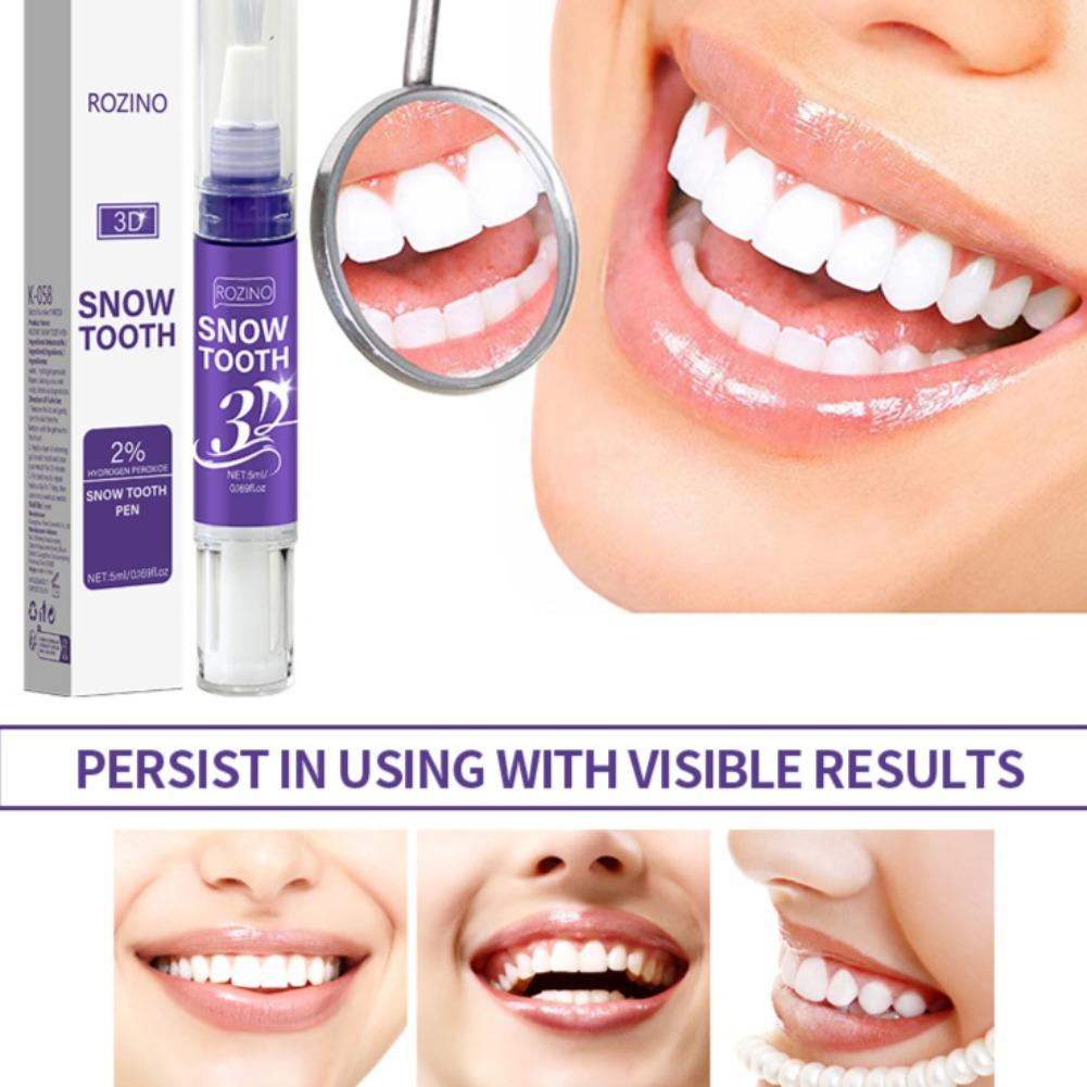 3D Snow Tandbleekpen, Tandkleu - Teeth Whitening Pens recensie en prijs