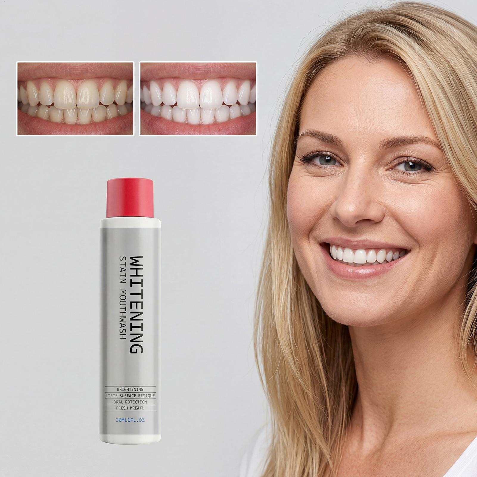 30ml Vlekkenverwijderende Mond - Teeth Whitening Mouthwash recensie en prijs