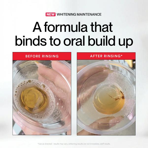 Hismile ID Whitening Stain Mon - Teeth Whitening Mouthwash recensie en prijs