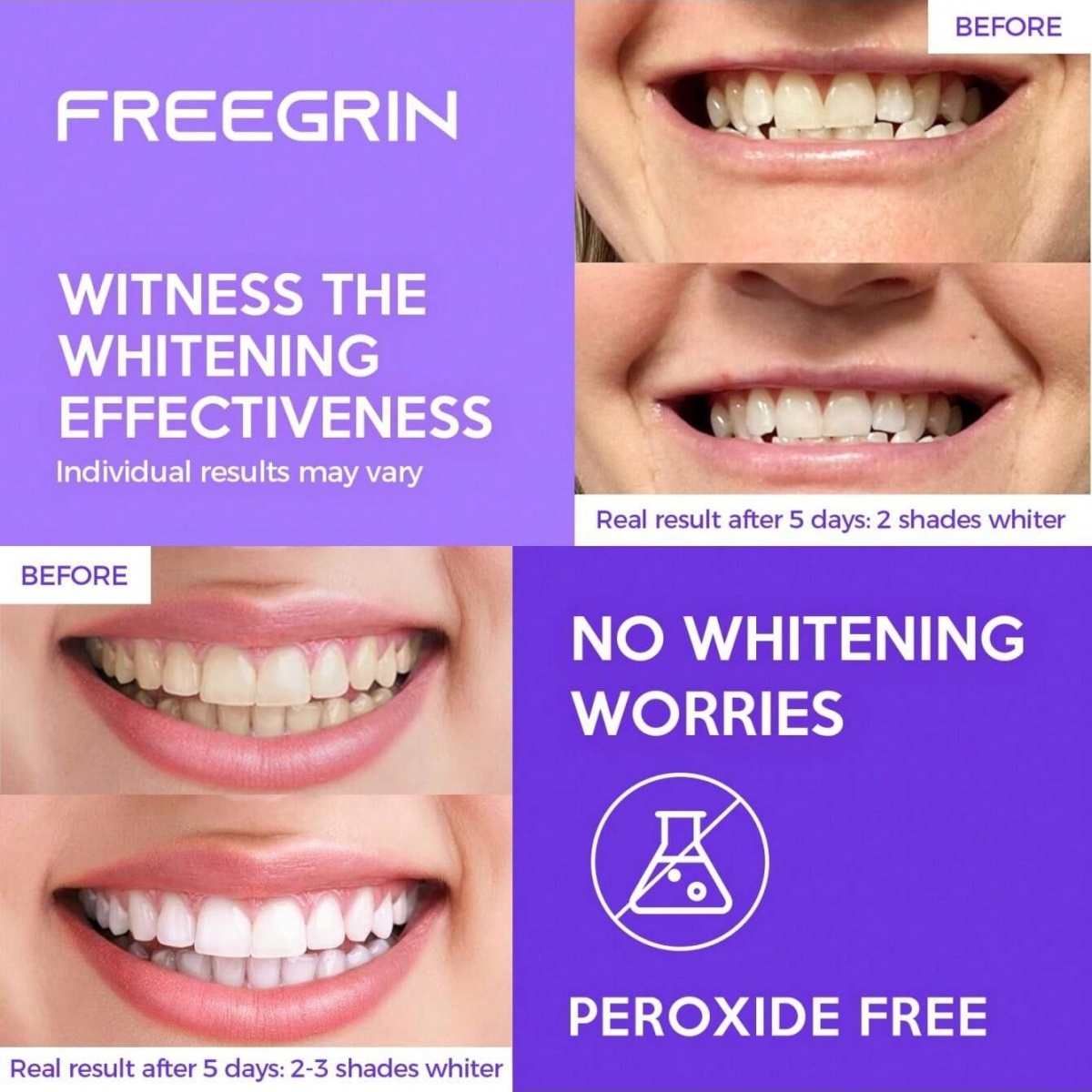 Deluxe Tanden Whitening Sticke - Teeth Whitening Near Me recensie en prijs