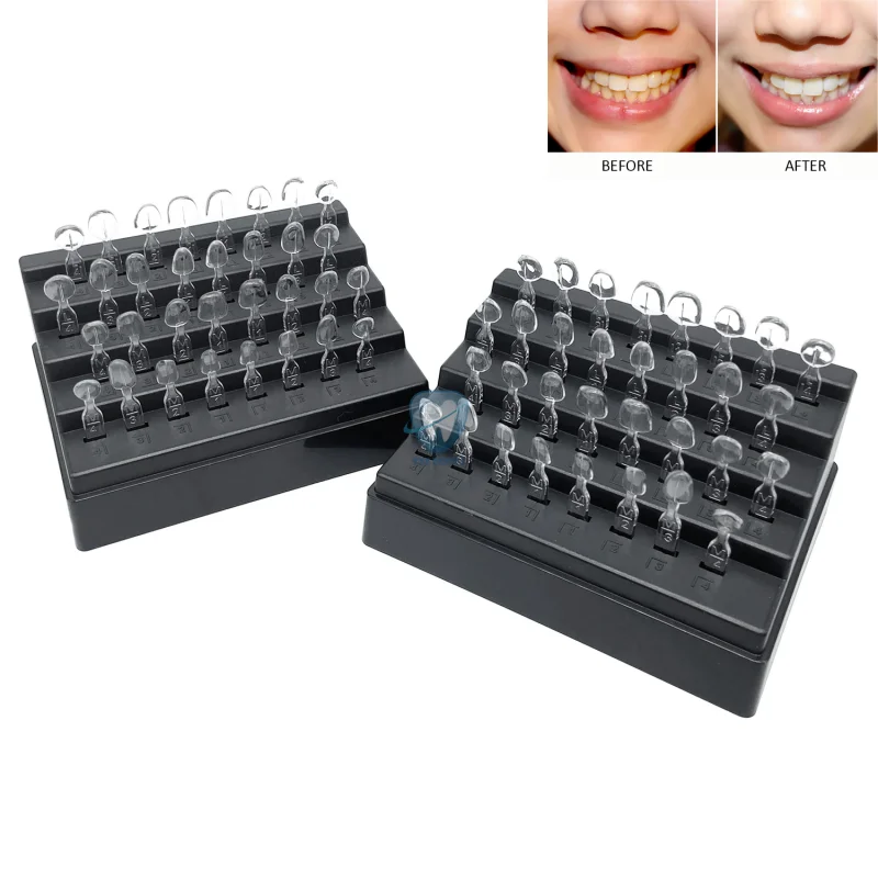 32 stks/set Tandheelkundige Fi - Teeth Whitening Moulds recensie en prijs
