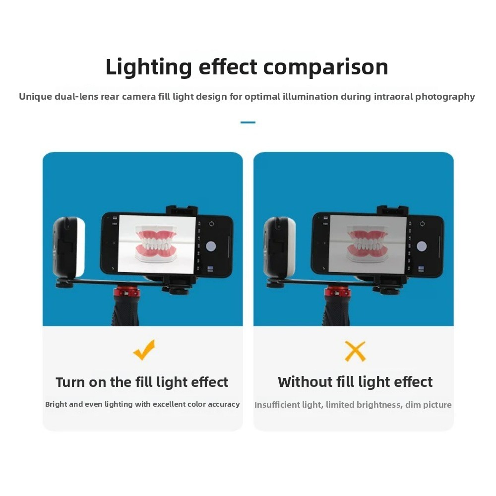 Tandheelkundige fotografielamp - Teeth Whitening Kit recensie en prijs