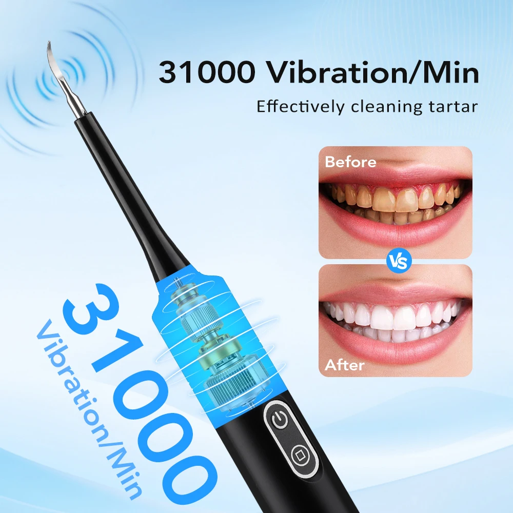 Elektrische sonische vibratie  - Teeth Whitening Mouthwash recensie en prijs
